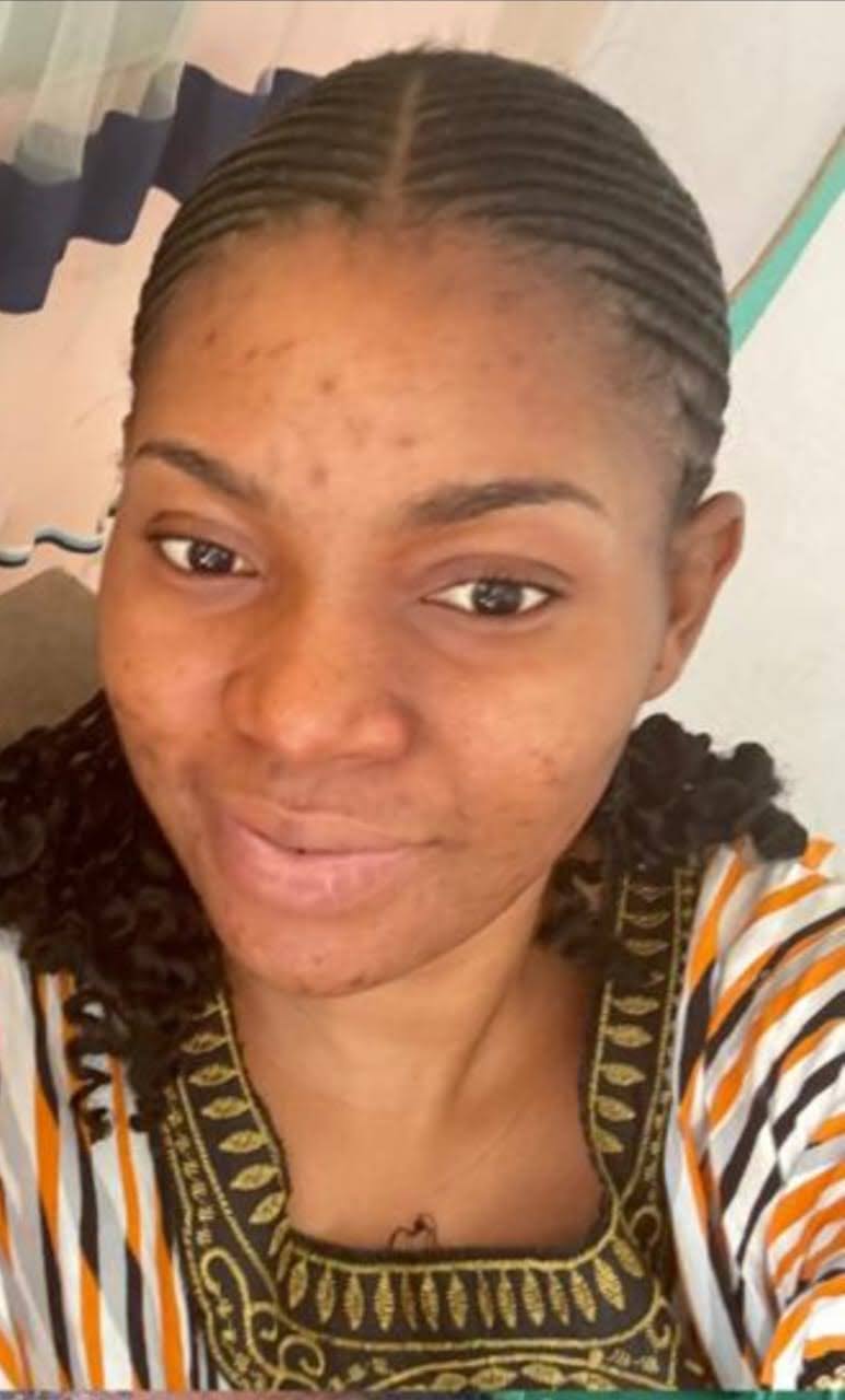 Skincare ingredients to avoid for dark spots on melanin-rich skin