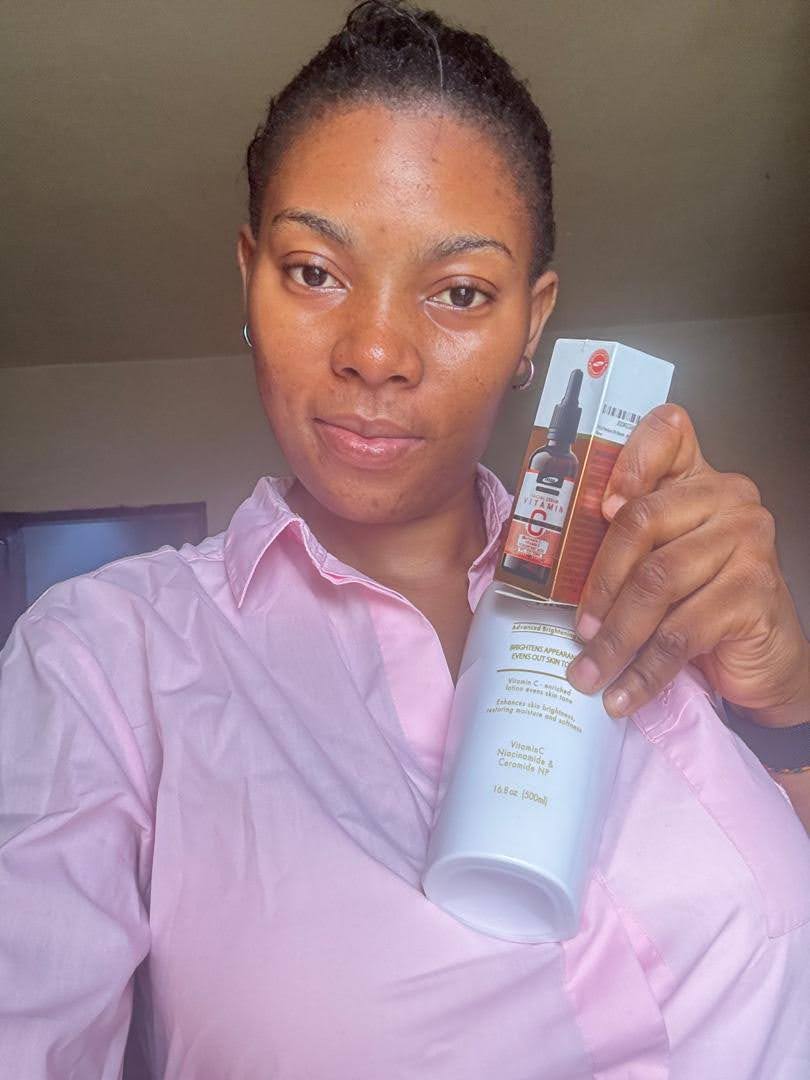 Comparing types of hyperpigmentation on melanin-rich skin