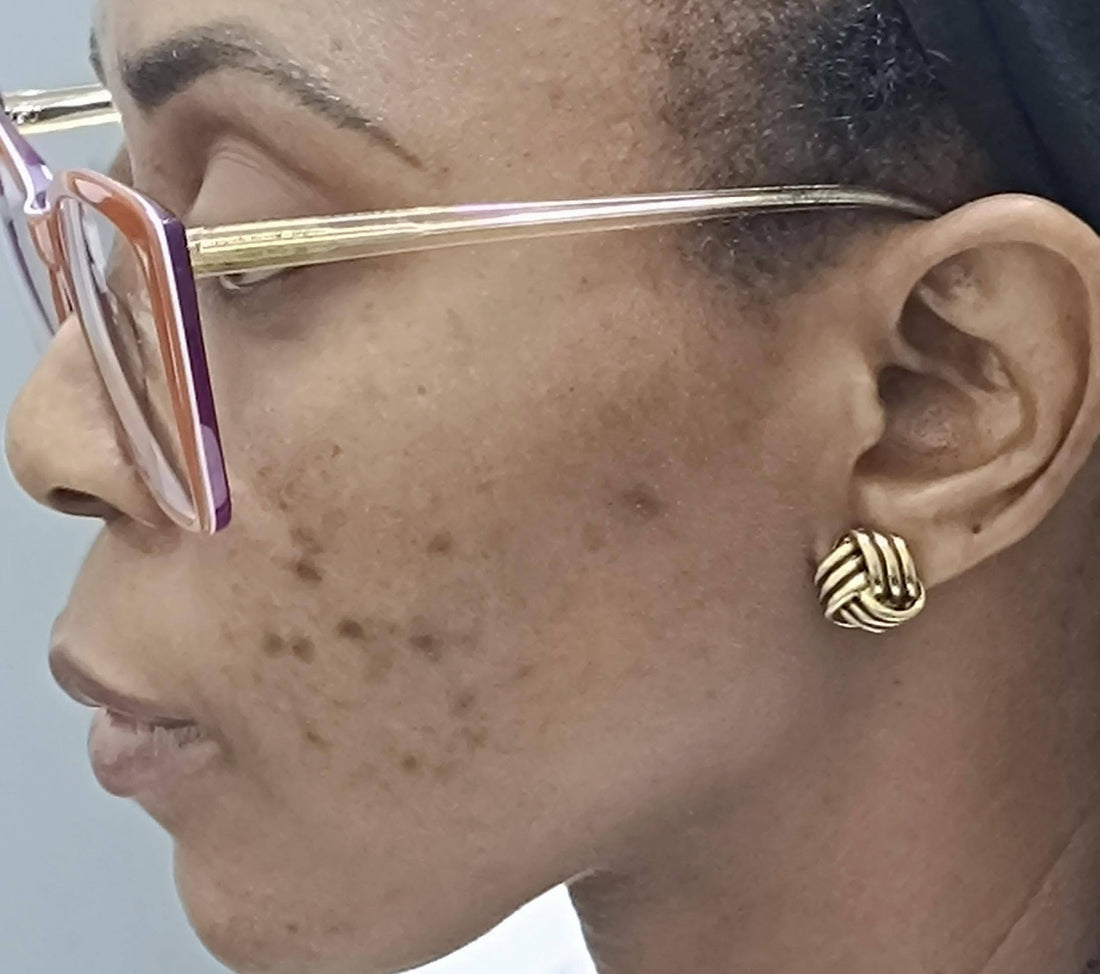 The right order to apply skincare for melanin-rich skin