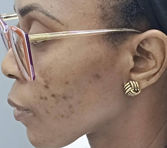 The right order to apply skincare for melanin-rich skin