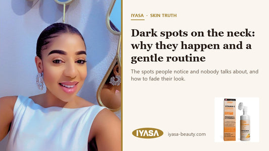 Mirabel, founder of IYASA — Dark spots on the neck: why they happen and a gentle routine
