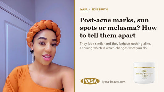 Mirabel, founder of IYASA — post-acne marks, sun spots or melasma