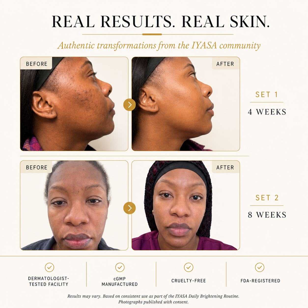 Brightening Set for Melanin-Rich Skin